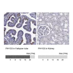 Atlas Antibodies Anti-PIH1D3 Antibody