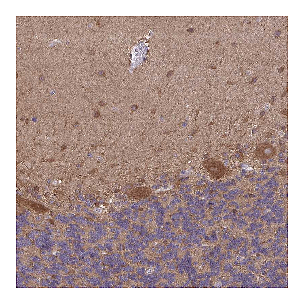 Atlas Antibodies Anti-PIGZ Antibody