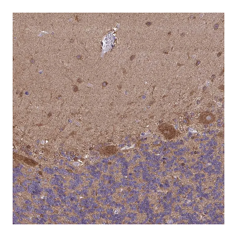 Atlas Antibodies Anti-PIGZ Antibody