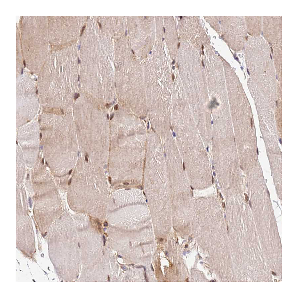 Atlas Antibodies Anti-PIH1D1 Antibody