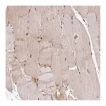 Atlas Antibodies Anti-PIH1D1 Antibody