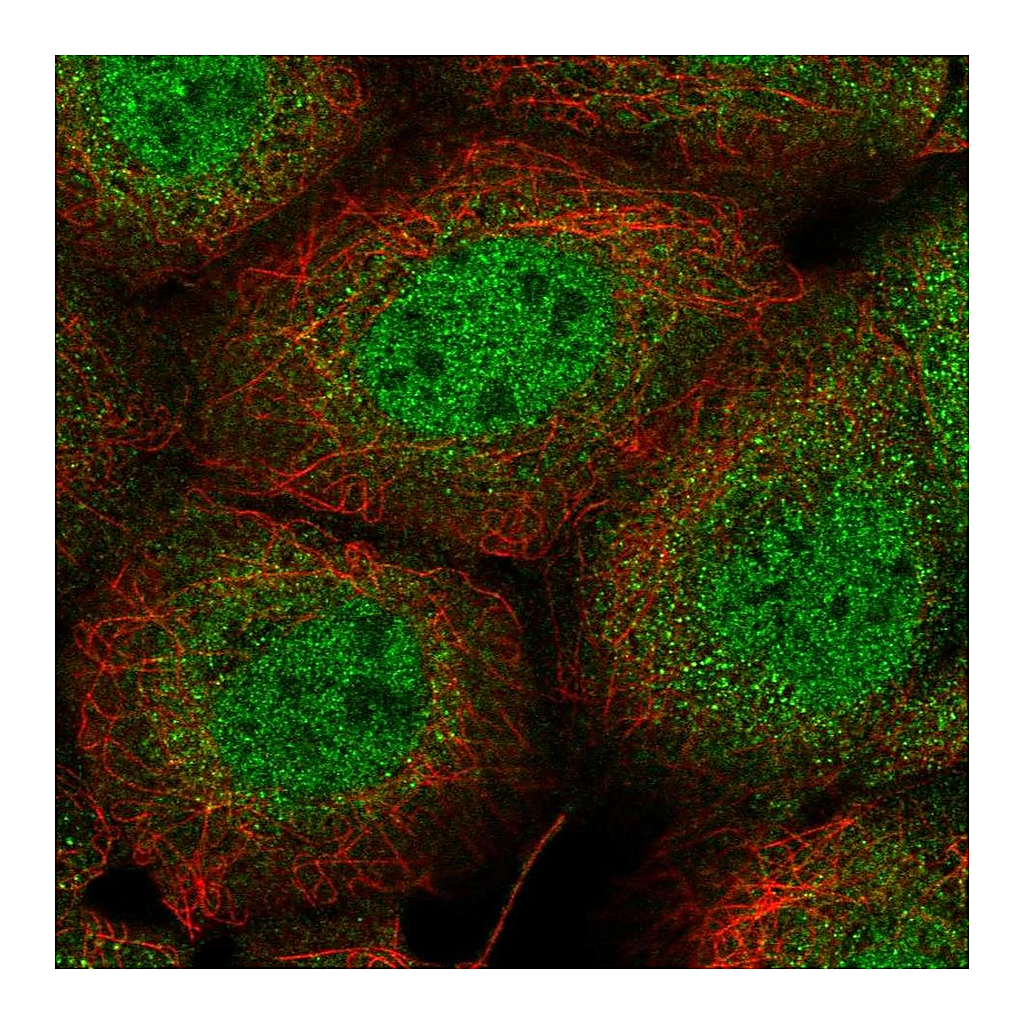 Atlas Antibodies Anti-PIK3C2B Antibody