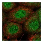 Atlas Antibodies Anti-PIK3C2B Antibody