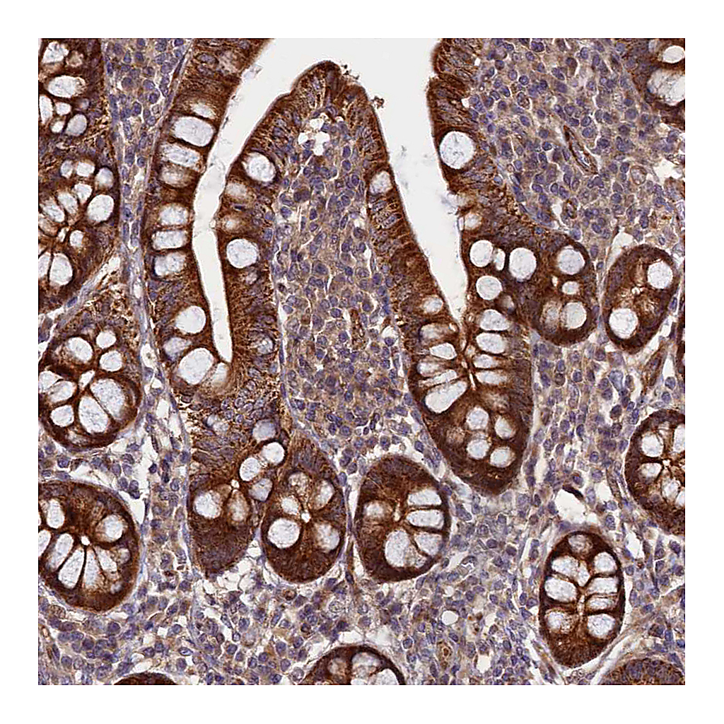Atlas Antibodies Anti-PIK3C3 Antibody
