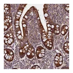 Atlas Antibodies Anti-PIK3C3 Antibody