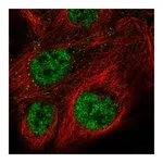 Atlas Antibodies Anti-PIK3CB Antibody