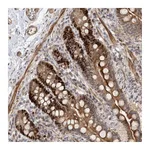 Atlas Antibodies Anti-PIK3C2A Antibody