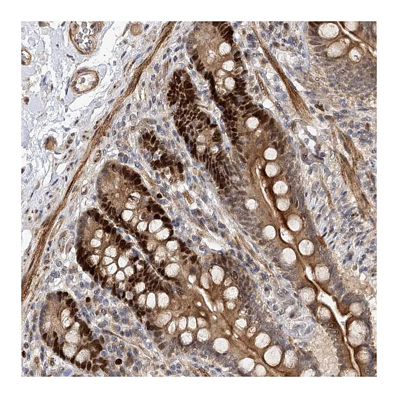 Atlas Antibodies Anti-PIK3C2A Antibody