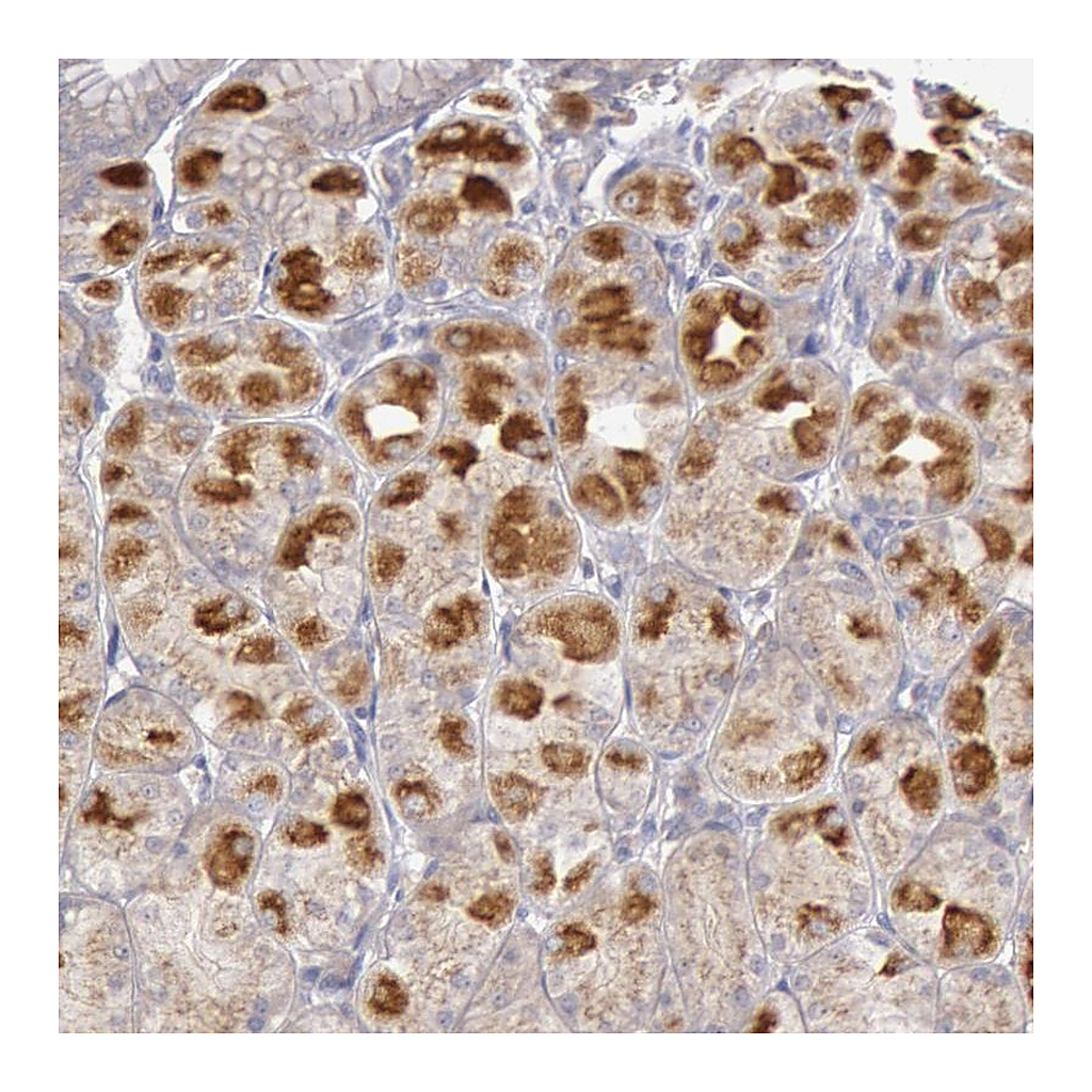 Atlas Antibodies Anti-PIK3R1 Antibody