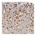 Atlas Antibodies Anti-PIK3R1 Antibody