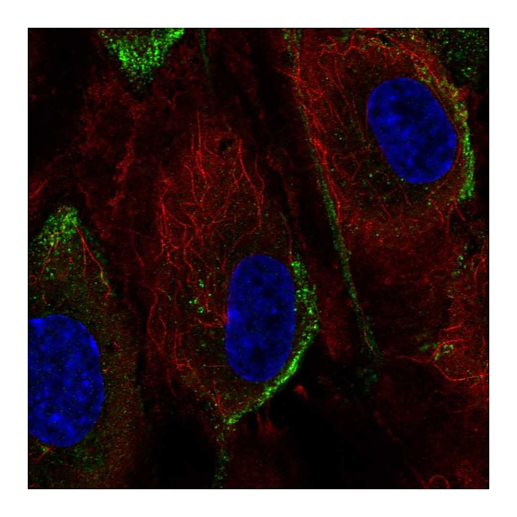 Atlas Antibodies Anti-PIK3CG Antibody