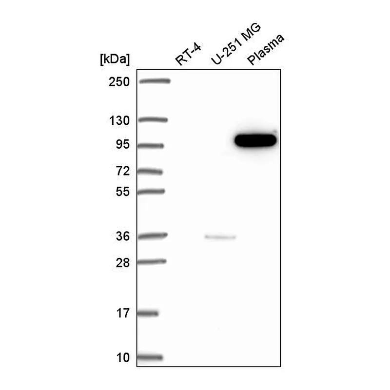 Atlas Antibodies Anti-PIK3CB Antibody
