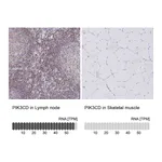 Atlas Antibodies Anti-PIK3CD Antibody