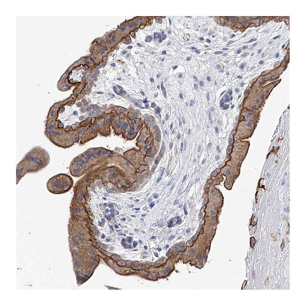 Atlas Antibodies Anti-PIK3C2B Antibody