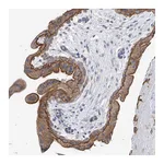 Atlas Antibodies Anti-PIK3C2B Antibody