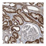 Atlas Antibodies Anti-PIK3R4 Antibody