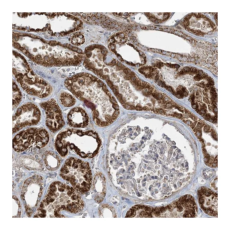 Atlas Antibodies Anti-PIK3R4 Antibody