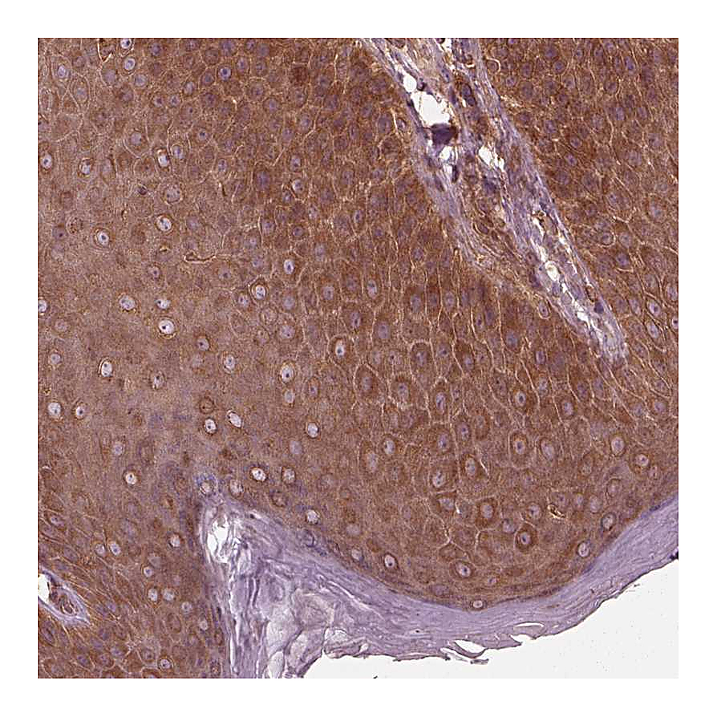 Atlas Antibodies Anti-PIK3R2 Antibody