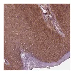 Atlas Antibodies Anti-PIK3R2 Antibody