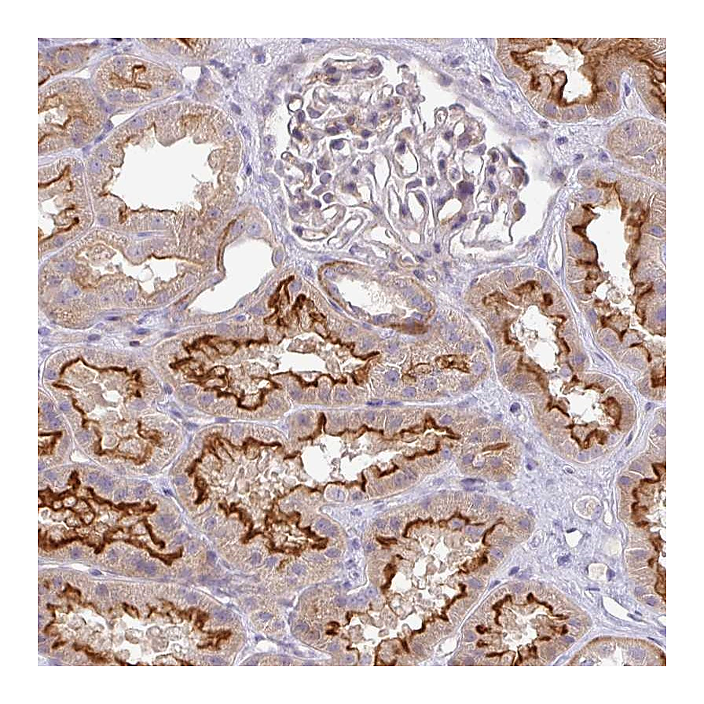 Atlas Antibodies Anti-PIK3R5 Antibody