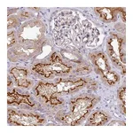 Atlas Antibodies Anti-PIK3R5 Antibody