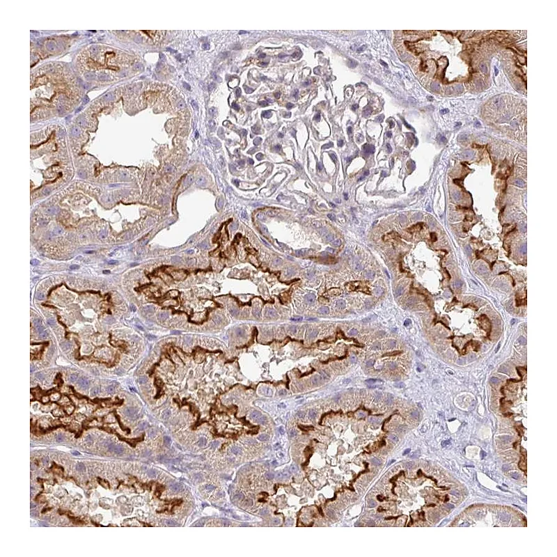 Atlas Antibodies Anti-PIK3R5 Antibody