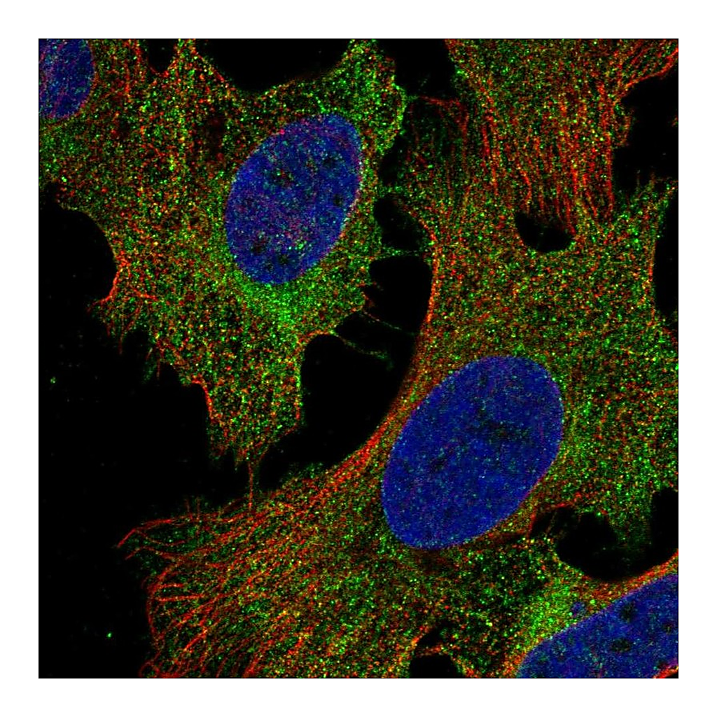 Atlas Antibodies Anti-PIK3R5 Antibody