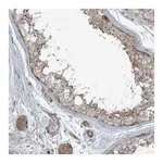 Atlas Antibodies Anti-PIK3R4 Antibody
