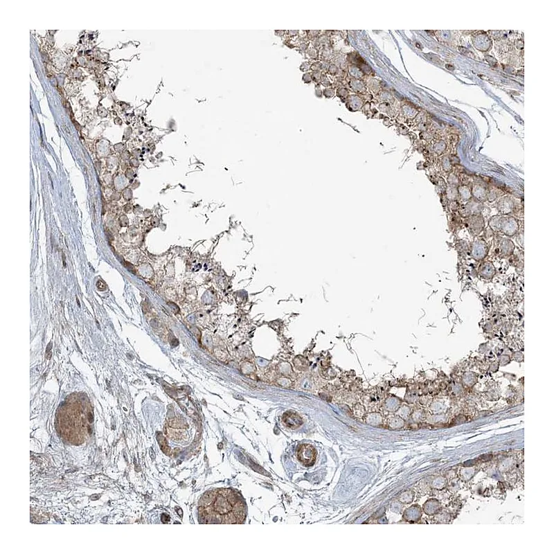 Atlas Antibodies Anti-PIK3R4 Antibody