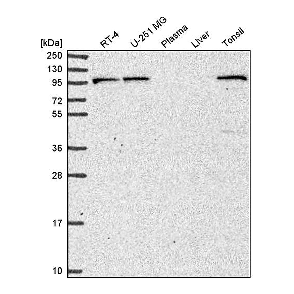Atlas Antibodies Anti-PIK3R5 Antibody