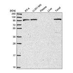Atlas Antibodies Anti-PIK3R5 Antibody