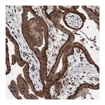 Atlas Antibodies Anti-PIK3R6 Antibody