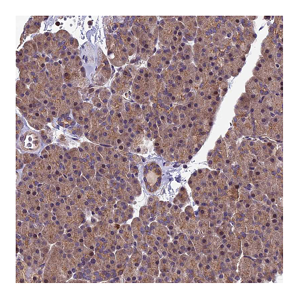 Atlas Antibodies Anti-PIKFYVE Antibody