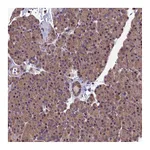 Atlas Antibodies Anti-PIKFYVE Antibody