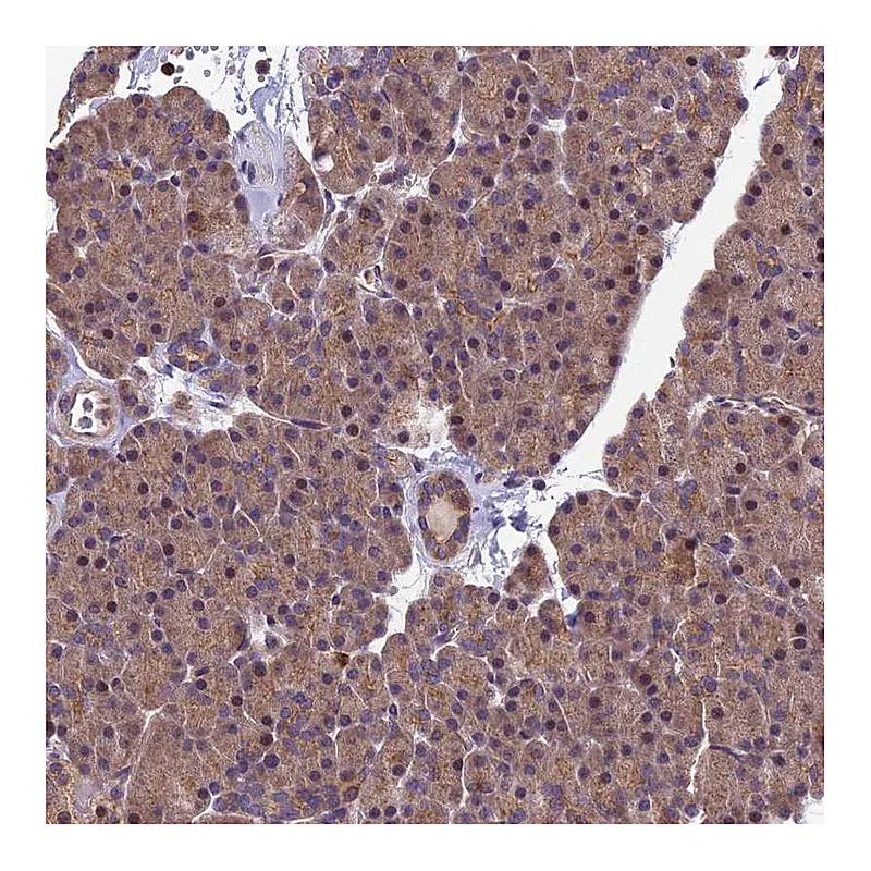 Atlas Antibodies Anti-PIKFYVE Antibody