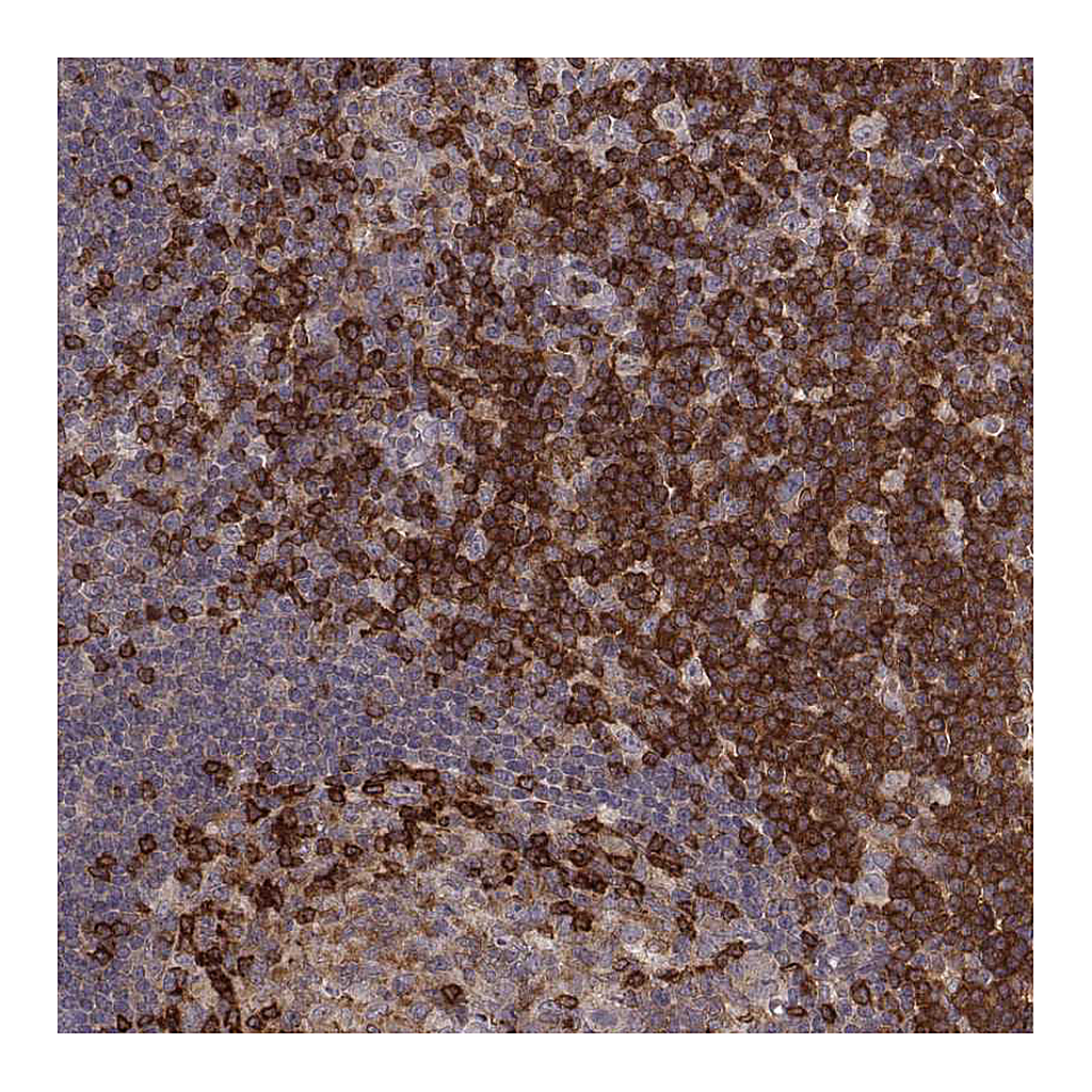 Atlas Antibodies Anti-PILRA Antibody