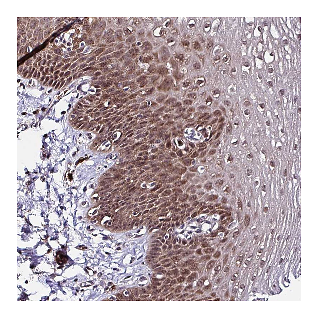 Atlas Antibodies Anti-PIN4 Antibody