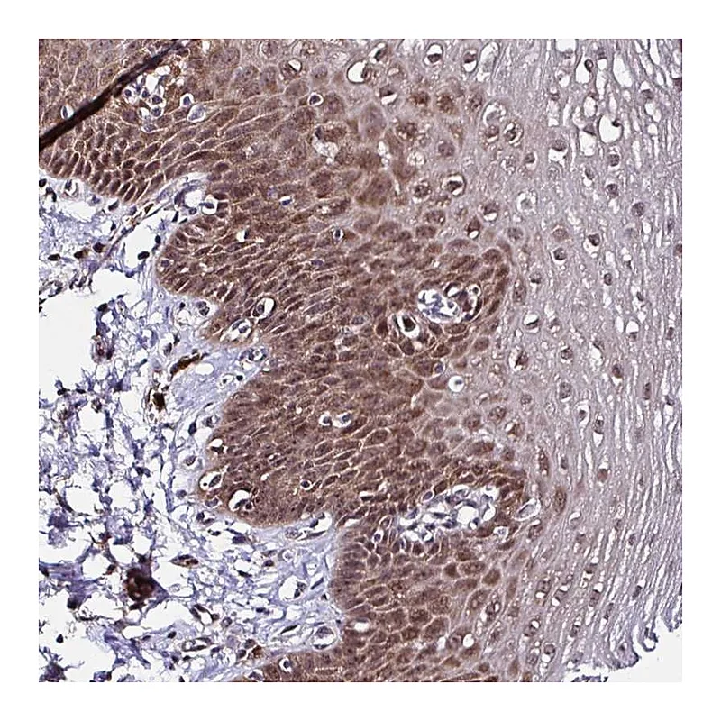 Atlas Antibodies Anti-PIN4 Antibody