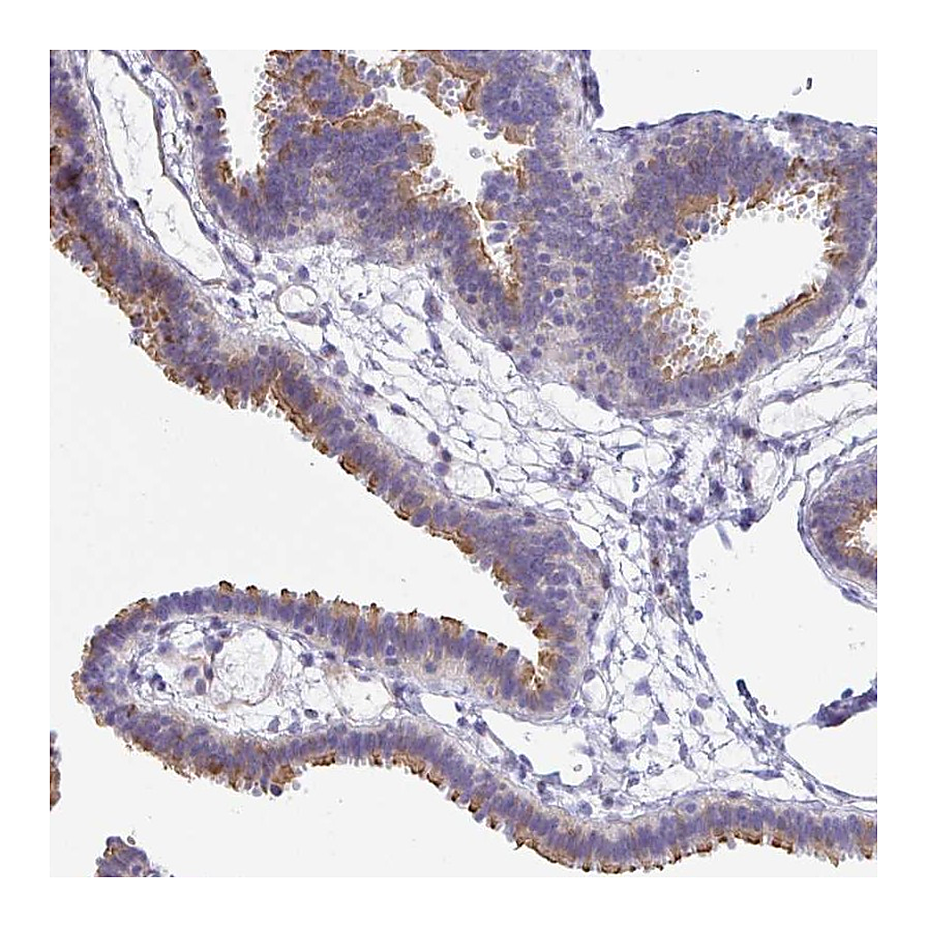 Atlas Antibodies Anti-PINLYP Antibody
