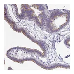 Atlas Antibodies Anti-PINLYP Antibody