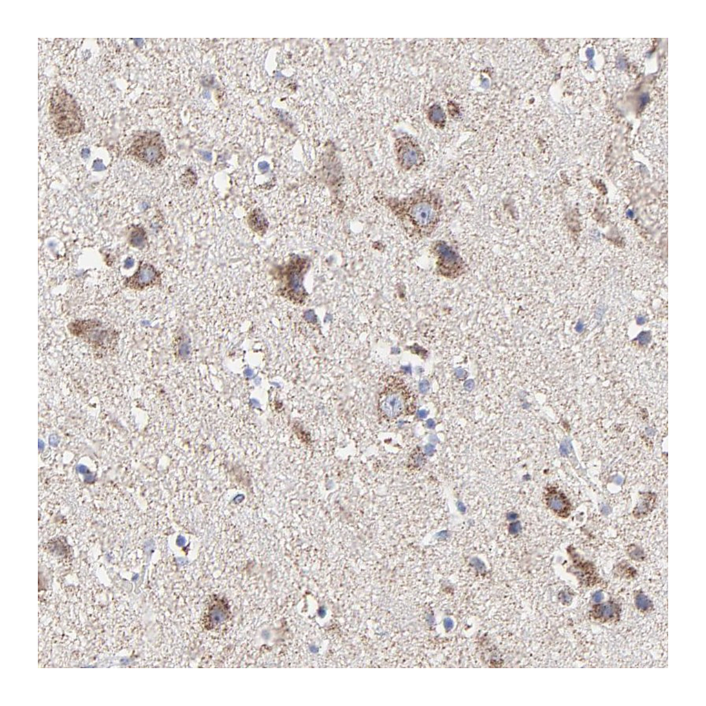 Atlas Antibodies Anti-PINK1 Antibody