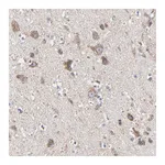 Atlas Antibodies Anti-PINK1 Antibody