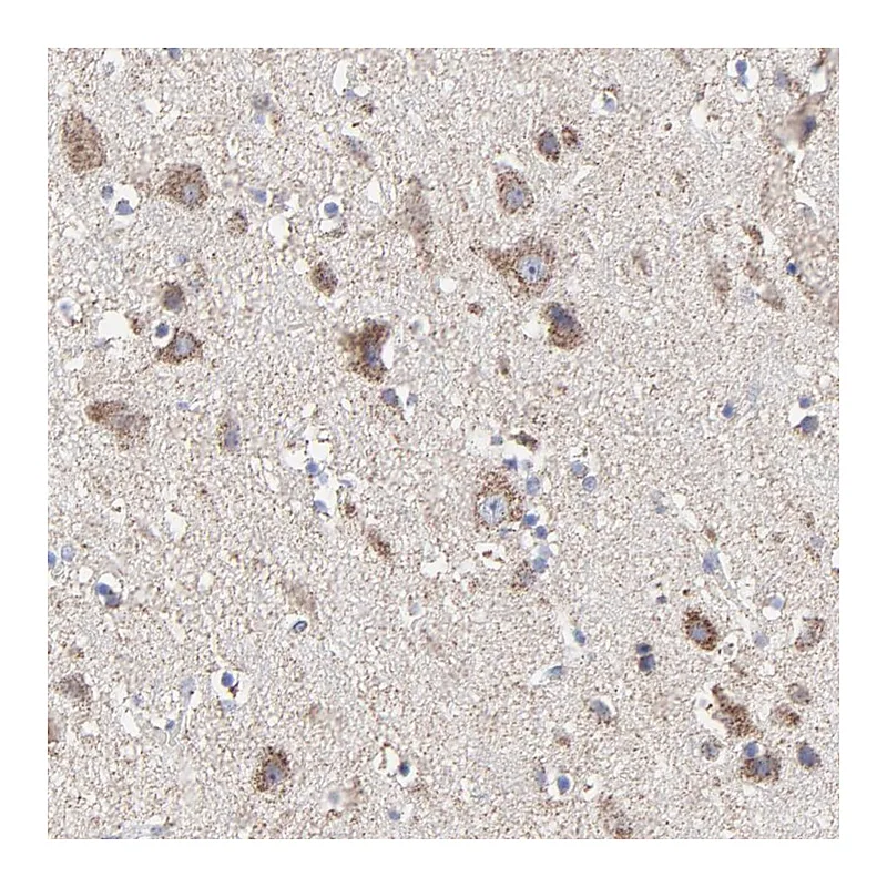 Atlas Antibodies Anti-PINK1 Antibody