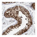 Atlas Antibodies Anti-PINX1 Antibody