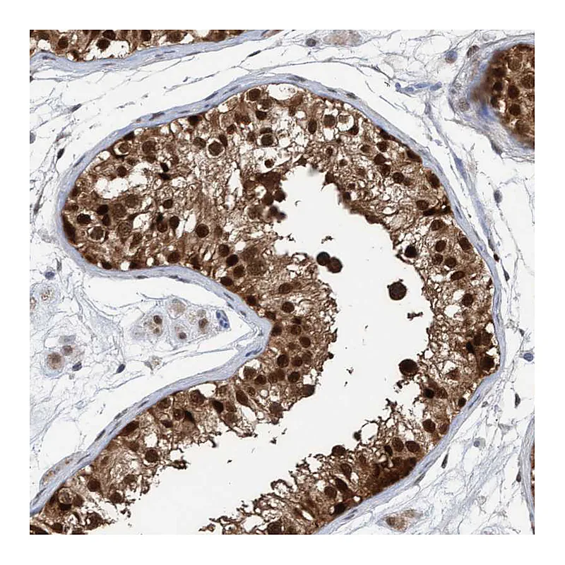Atlas Antibodies Anti-PINX1 Antibody