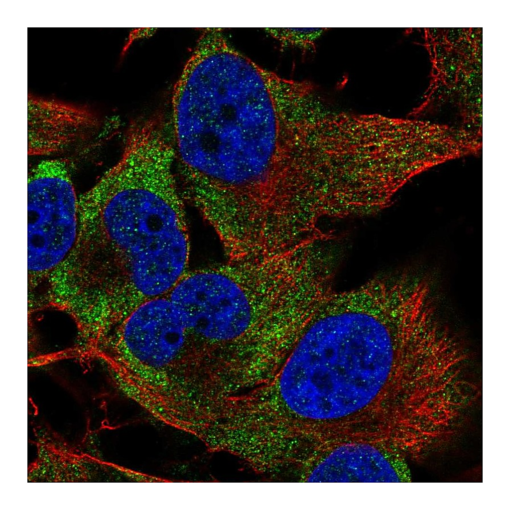 Atlas Antibodies Anti-PIM3 Antibody