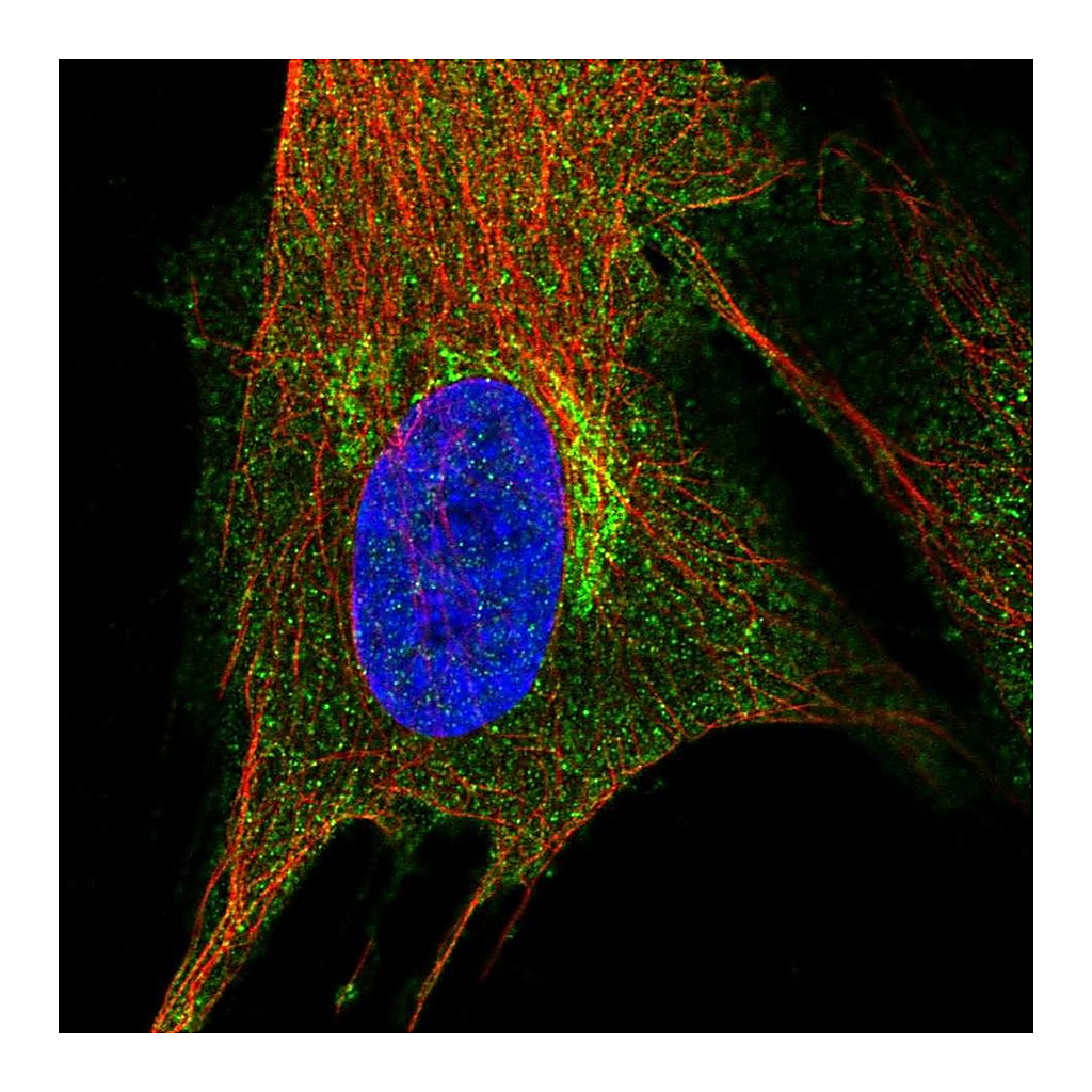 Atlas Antibodies Anti-PIP4K2A Antibody