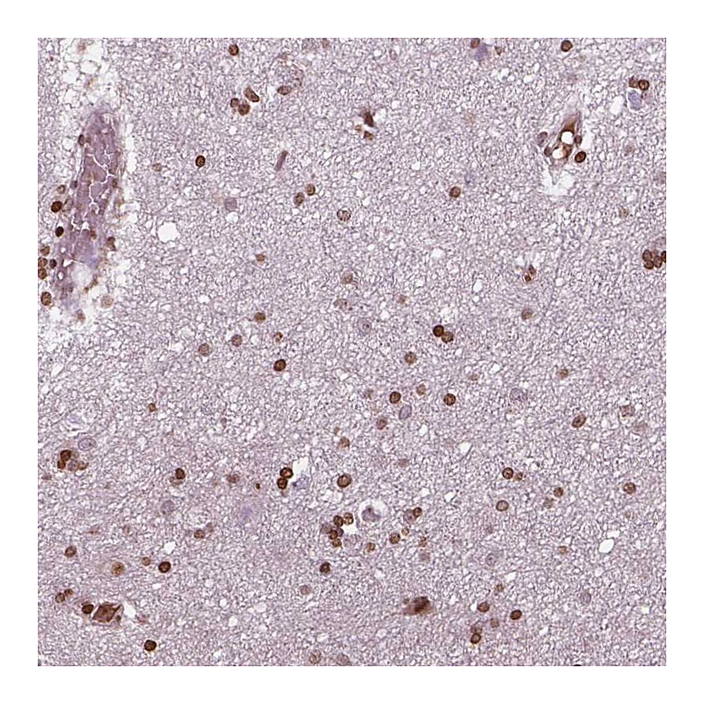 Atlas Antibodies Anti-PIP4K2A Antibody