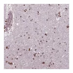 Atlas Antibodies Anti-PIP4K2A Antibody