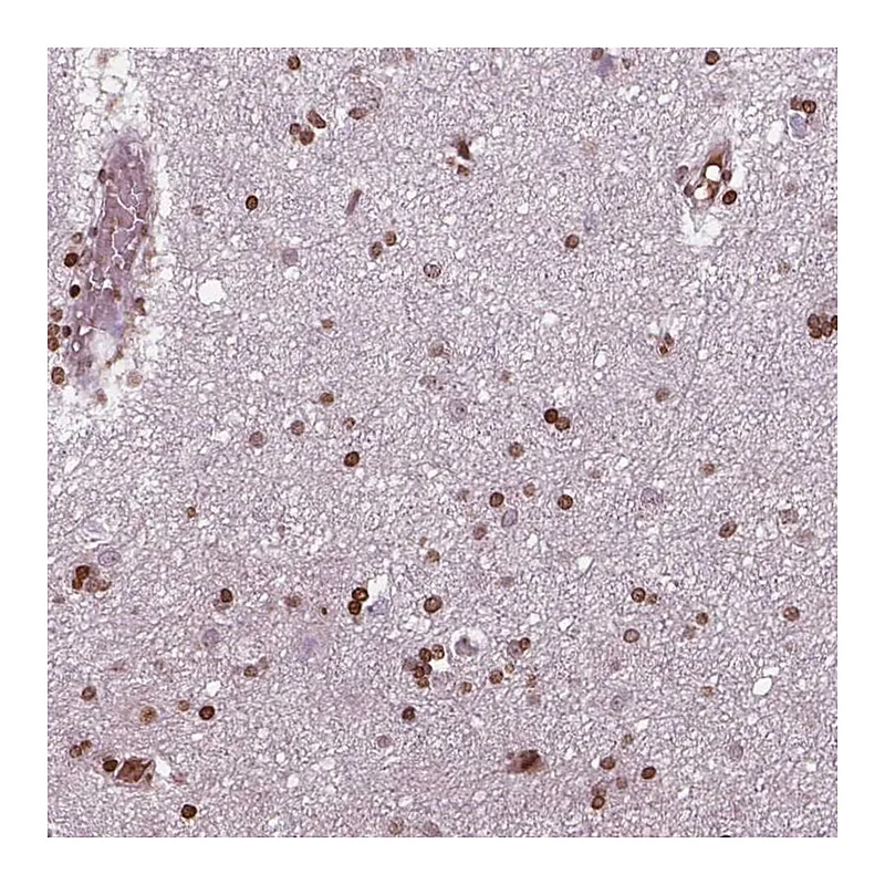 Atlas Antibodies Anti-PIP4K2A Antibody